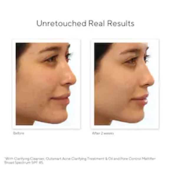 MURADÂ Pore Control Mattifier and SPF 45 - Picture 5 of 11